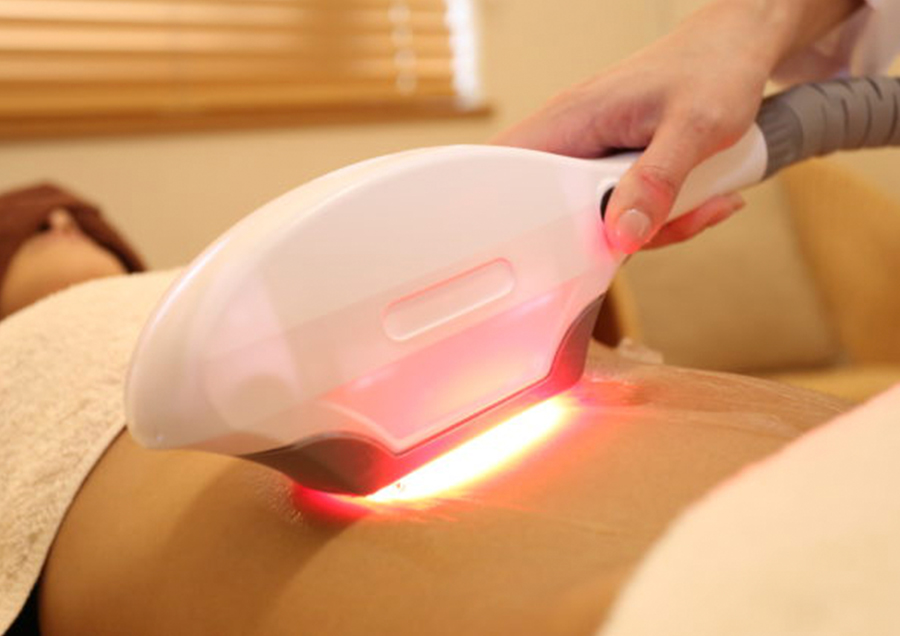 Eライト光で脱毛施術中の写真